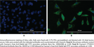 YTHDC2 Polyclonal Antibody
