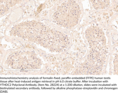 YTHDC2 Polyclonal Antibody