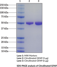 Citrullinated GFAP (human, recombinant) (ALXDRD, Glial Fibrillary Acidic Protein, Intermediate Filament Protein)