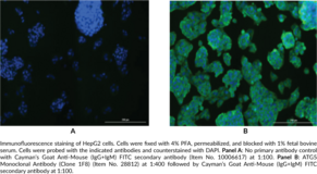 ATG5 Monoclonal Antibody (Clone 1F8) (APG5-like, hAPG5, Apoptosis-specific Protein, Autophagy Protein 5, Autophagy-related 5)