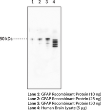 GFAP Monoclonal Antibody (Clone 8E6) (ALXDRD, Glial Fibrillary Acidic Protein, Intermediate Filament Protein)