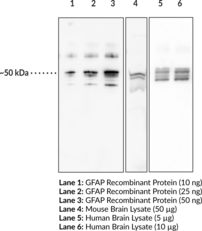 GFAP Polyclonal Antibody (ALXDRD, Glial Fibrillary Acidic Protein, Intermediate Filament Protein)