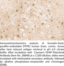 GFAP Polyclonal Antibody