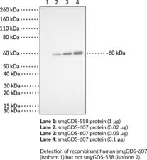smgGDS-607 Monoclonal Antibody (Clone 4D6) (RAP1GDS1, Rap1 GTPase-GDP Dissociation Stimulator 1)