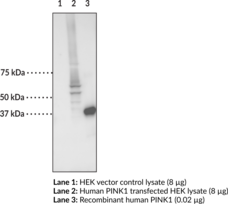 PINK1 Monoclonal Antibody (Clone 3E8) (BRPK, PARK6, PTEN Induced Putative Kinase 1, PTEN Inducible Kinase 1, Serine/Threonine-Protein Kinase PINK1)