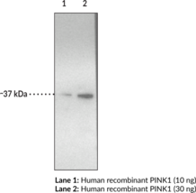 PINK1 Monoclonal Antibody (Clone 3E8)
