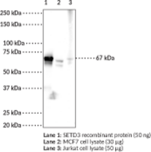 SETD3 Monoclonal Antibody (Clone 1B4) (Actin Histidine N-Methyltransferase, C14orf154, Chromosome 14 Open Reading Frame 154, HSETD3, SET Domain-containing 3, Actin Histidine Methyltransferase, SET Domain-containing Protein 3)