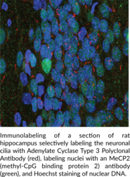 Adenylate Cyclase Type 3 Polyclonal Antibody