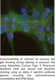 Adenylate Cyclase Type 3 Polyclonal Antibody