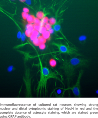 NeuN Monoclonal Antibody (Clone 1B7)
