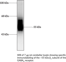 GABAAReceptor beta2Subunit Polyclonal Antibody