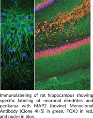 MAP2 (bovine) Monoclonal Antibody (Clone 4H5)