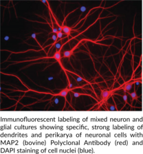 MAP2 (bovine) Polyclonal Antibody