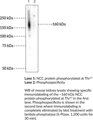 NCC (Phospho-Thr53) Polyclonal Antibody (Sodium Chloride Symporter)