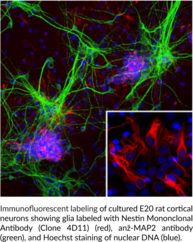 Nestin Monoclonal Antibody (Clone 4D11)
