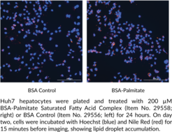 BSA-Palmitate Saturated Fatty Acid Complex (5 mM)