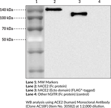 ACE2 (human) Monoclonal Antibody (Clone AC18F) (ACE-related Carboxypeptidase, ACEH, Angiotensin-Converting Enzyme 2, Angiotensin-Converting Enzyme Homolog, Metalloprotease MPROT15)