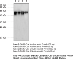SARS-CoV/SARS-CoV-2 Nucleocapsid Protein Rabbit Monoclonal Antibody (Clone 001) (SARS-CoV/SARS-CoV-2 NP, SARS-CoV/SARS-CoV-2 Nucleoprotein, Severe Acute Respiratory Syndrome Coronavirus/Severe Acute Respiratory Syndrome Coronavirus 2 Nucleocapsid Protein)