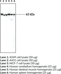 Glucose-6-phosphate Isomerase Monoclonal Antibody (Clone 5B6) (GPI, PGI, PHI, Phosphoglucose Isomerase, Phosphohexose Isomerase)