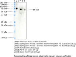 Sphingosine Kinase 2 Monoclonal Antibody (Clone 2C6) (SK2, SPHK2, SPK2)