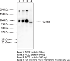ACE2 (human) Monoclonal Antibody (Clone 8G5) (ACEH, ACE-related Carboxypeptidase, Angiotensin-converting Enzyme 2, Angiotensin-converting Enzyme Homolog, Metalloprotease MPROT15)