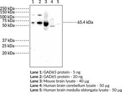GAD65 Monoclonal Antibody (Clone 9B10) (GAD2, GAD64, Glutamate Decarboxylase 2, Glutamate Decarboxylase 65 kDa Isoform, Glutamic Acid Decarboxylase 65)