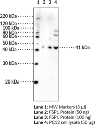 sermorelin ipamorelin blend reddit CJC-1295 + Ipamorelin