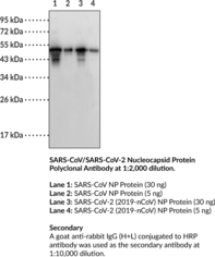 SARS-CoV/SARS-CoV-2 Nucleocapsid Protein Polyclonal Antibody (SARS-CoV/SARS-CoV-2 NP, SARS-CoV/SARS-CoV-2 Nucleoprotein, Severe Acute Respiratory Syndrome Coronavirus, Severe Acute Respiratory Syndrome Coronavirus 2 Nucleocapsid Protein)