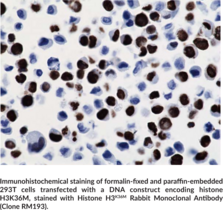 Histone H3K36M Rabbit Monoclonal Antibody (Clone RM193)