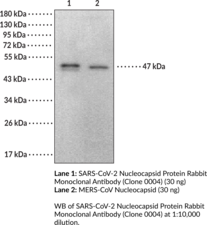 SARS-CoV-2 Nucleocapsid Protein Rabbit Monoclonal Antibody (Clone 0004) (SARS-CoV-2 NP, SARS-CoV-2 Nucleoprotein, Severe Acute Respiratory Syndrome Coronavirus 2 Nucleocapsid Protein, COVID-19 NP, COVID-19 Nucleoprotein, COVID-19 Nucleocapsid Protein, 2019-nCoV NP, 2019-nCoV Nucleoprotein, 2019-nCoV Nucleocapsid Protein)