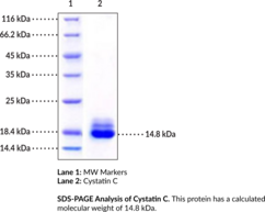 Cystatin C (human, recombinant) (ARMD11, CYS3, Cystatin 3)