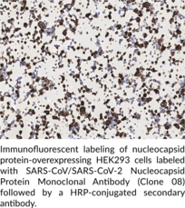 SARS-CoV/SARS-CoV-2 Nucleocapsid Protein Monoclonal Antibody (Clone 08)