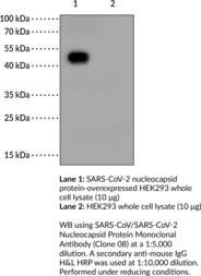 SARS-CoV/SARS-CoV-2 Nucleocapsid Protein Monoclonal Antibody (Clone 08)