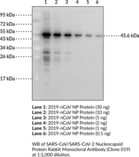 SARS-CoV/SARS-CoV-2 Nucleocapsid Protein Rabbit Monoclonal Antibody (Clone 019) (2019-nCoV NP, 2019-nCoV Nucleoprotein, 2019-nCoV Nucleocapsid Protein, COVID-19 NP, COVID-19 Nucleoprotein, COVID-19 Nucleocapsid Protein, SARS-CoV-2 NP, SARS-CoV-2 Nucleoprotein, Severe Acute Respiratory Syndrome Coronavirus 2 Nucleocapsid Protein)