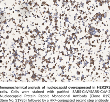 SARS-CoV/SARS-CoV-2 Nucleocapsid Protein Rabbit Monoclonal Antibody (Clone 019)