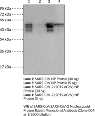 SARS-CoV/SARS-CoV-2 Nucleocapsid Protein Rabbit Monoclonal Antibody (Clone 004) (COVID-19 NP, COVID-19 Nucleocapsid Protein, COVID-19 Nucleoprotein, 2019-nCoV NP, 2019-nCoV Nucleocapsid Protein, 2019-nCoV Nucleoprotein, SARS-CoV-2 NP, SARS-CoV-2 Nucleoprotein, Severe Acute Respiratory Syndrome Coronavirus 2 Nucleocapsid Protein)