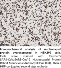 SARS-CoV/SARS-CoV-2 Nucleocapsid Protein Rabbit Monoclonal Antibody (Clone 004)