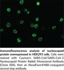 SARS-CoV/SARS-CoV-2 Nucleocapsid Protein Rabbit Monoclonal Antibody (Clone 004)