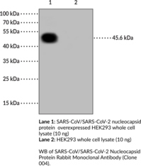 SARS-CoV/SARS-CoV-2 Nucleocapsid Protein Rabbit Monoclonal Antibody (Clone 004)
