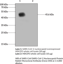 SARS-CoV/SARS-CoV-2 Nucleocapsid Protein Rabbit Monoclonal Antibody (Clone 040) (SARS-CoV/SARS-CoV-2 NP, SARS-CoV/SARS-CoV-2 Nucleoprotein, Severe Acute Respiratory Syndrome Coronavirus/Severe Acute Respiratory Syndrome Coronavirus 2 Nucleocapsid Protein)