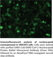 SARS-CoV/SARS-CoV-2 Nucleocapsid Protein Rabbit Monoclonal Antibody (Clone 040)