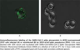 SARS-CoV/SARS-CoV-2 Spike Glycoprotein RBD Chimeric Monoclonal Antibody (Clone D004) (SARS-CoV/SARS-CoV-2 Spike RBD, SARS-CoV/SARS-CoV-2 Spike Receptor Binding Domain, SARS-CoV/SARS-CoV-2 Surface Glycoprotein RBD, SARS-CoV/SARS-CoV-2 Surface Glycoprotein Receptor Binding Domain, Severe Acute Respiratory Syndrome Coronavirus/Severe Acute Respiratory Syndrome Coronavirus 2 Spike Glycoprotein Receptor Binding Domain)