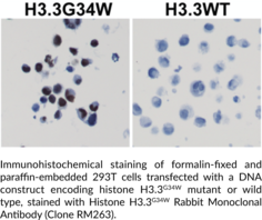 Histone H3.3G34W Rabbit Monoclonal Antibody (Clone RM263)