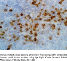 Igκ Light Chain (human) Rabbit Monoclonal Antibody (Clone RM126) (Immunoglobulin κ Light Chain)