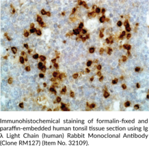 Igλ Light Chain (human) Rabbit Monoclonal Antibody (Clone RM127) (Igλ, Immunoglobulin λ Light Chain)