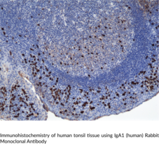IgA1 (human) Rabbit Monoclonal Antibody (Clone RM124) (Immunoglobulin A1)