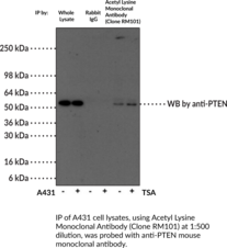 Acetyl Lysine Monoclonal Antibody (Clone RM101)