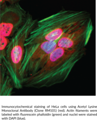 Acetyl Lysine Monoclonal Antibody (Clone RM101)