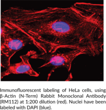 β-Actin (N-Term) Rabbit Monoclonal Antibody (RM112)