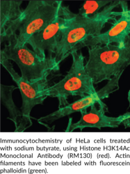 Histone H3K14Ac Monoclonal Antibody (RM130)